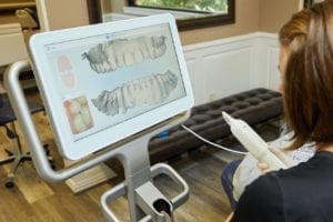 Invisalign process in Flower Mound, Texas