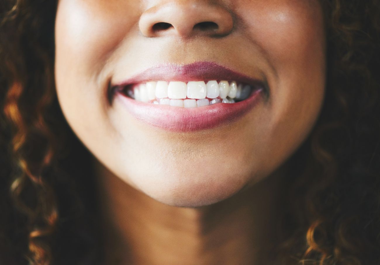 Widen a Narrow Mouth with Orthodontics Flower Mound, TX
