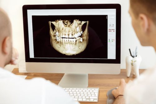 how-do-orthodontists-make-invisalign-flower-mound-tx