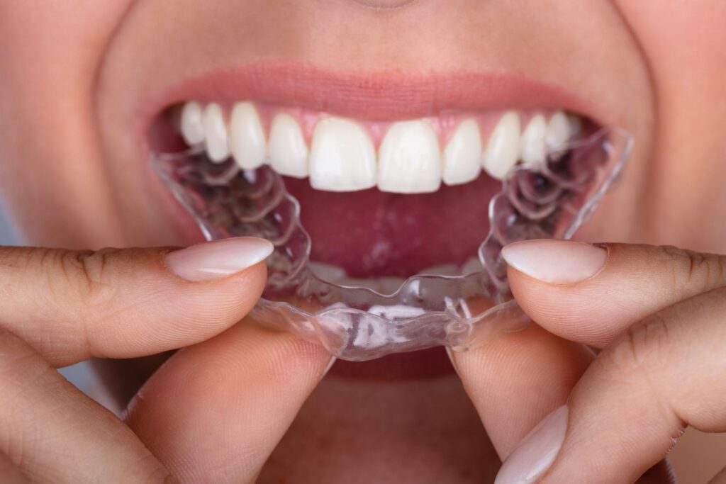 Invisalign teeth straightening treatment length