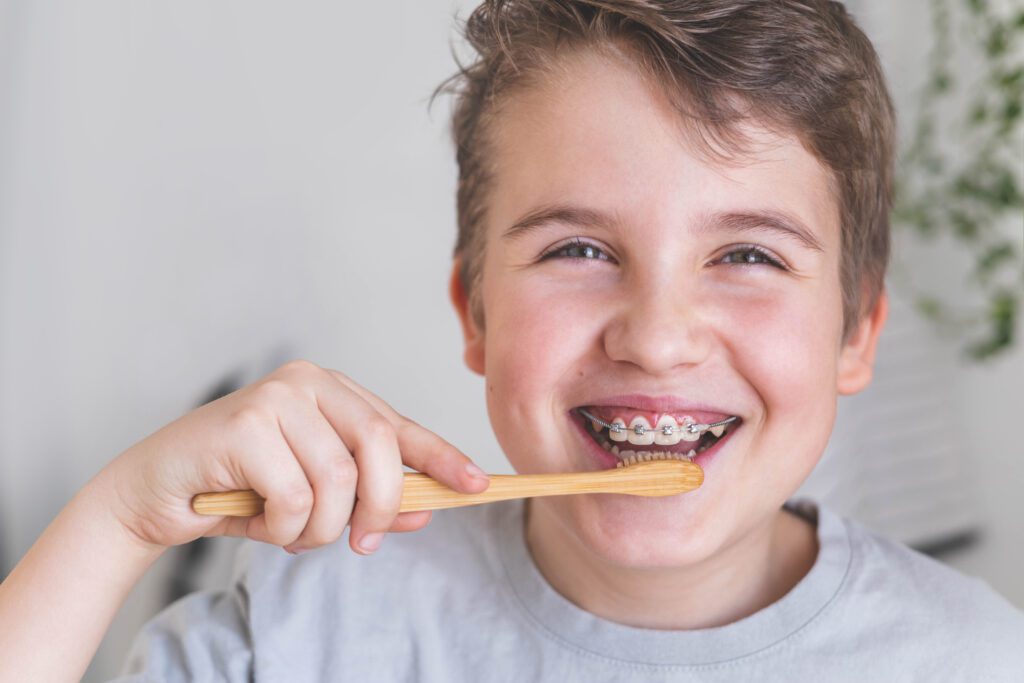 Maintaining good oral hygiene with braces helps in achieving the best possible outcome for your treatment.