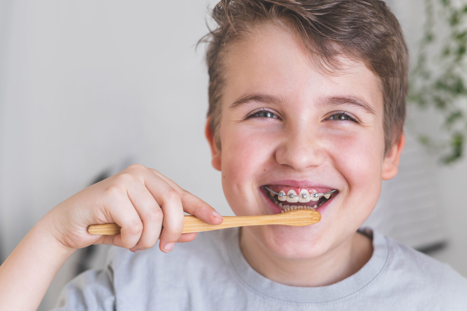 How to Maintain Oral Hygiene With Braces | Flower Mound, TX